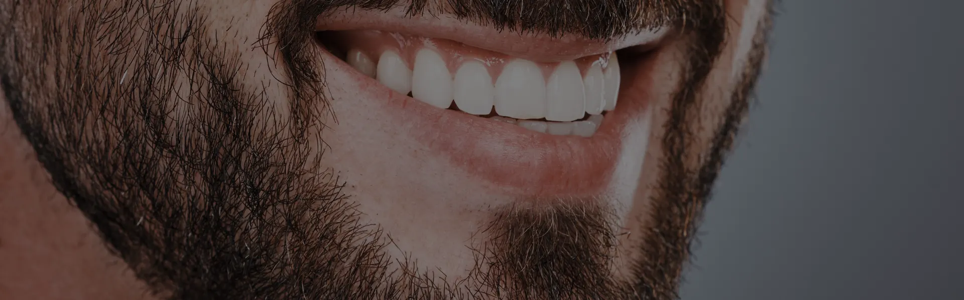 Close-up of a smiling bearded man’s teeth