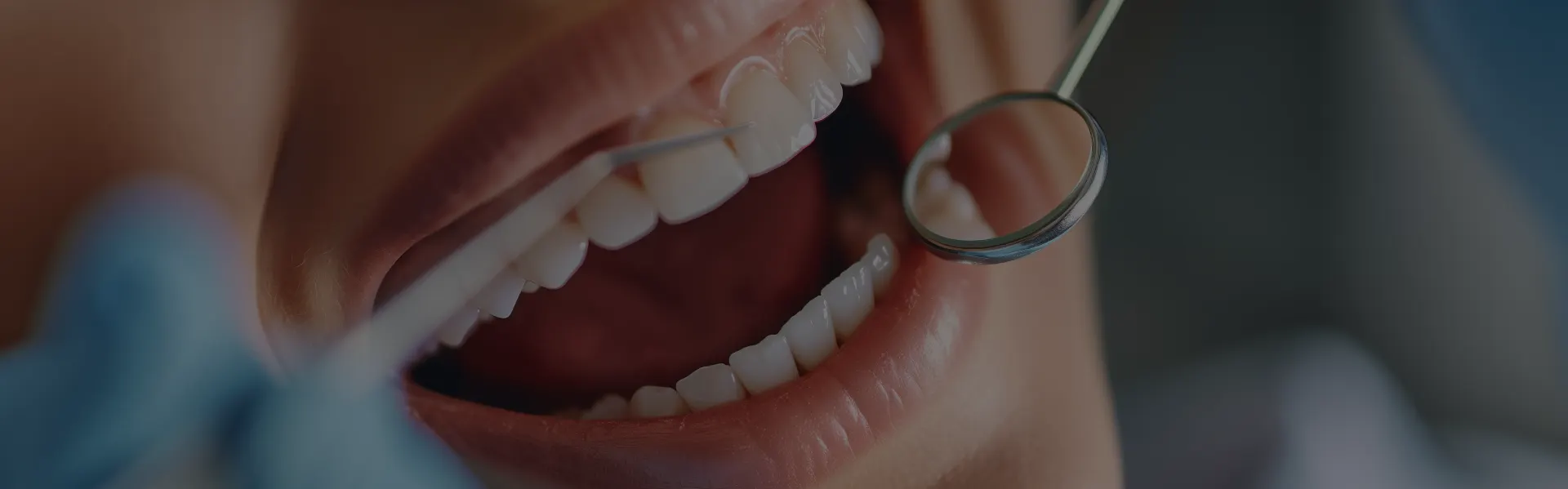 Close-up of teeth being checked with a dental mirror