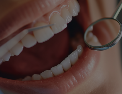 Porcelain Veneers vs Composite Veneers: Which is Right for You?