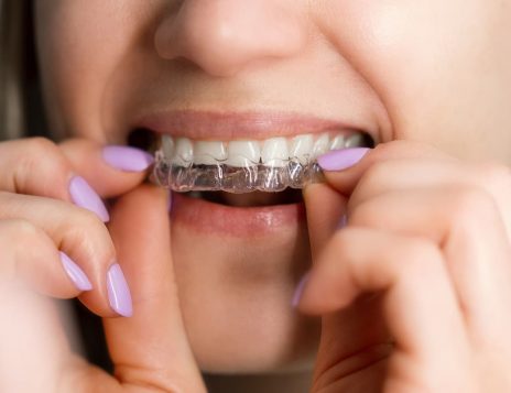 Straighten Your Smile with Invisalign in Chesham