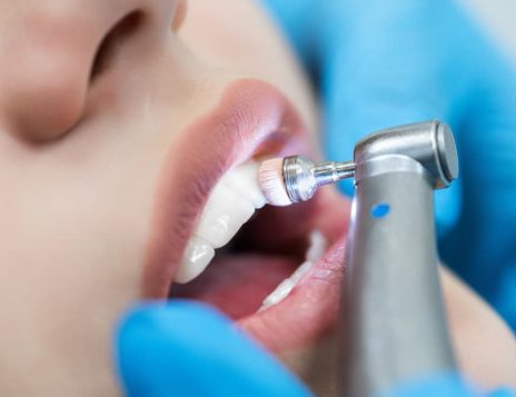 Keep Your Smile Healthy with Professional Teeth Cleaning in Chesham