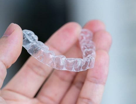 How Often Should You Change Invisalign Aligners in Chesham