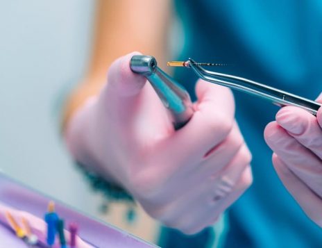 Benefits of Saving Your Natural Tooth with Root Canal